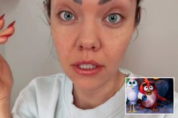 Frau ist entsetzt, nachdem Botox schief geht und sie wie ein Angry Bird aussehen lässt